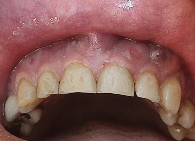 新型冠状病毒最新杀菌技术,曙光初现的希望之光揭秘